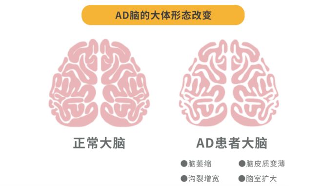 DM_20220926201452_001_结果.jpg